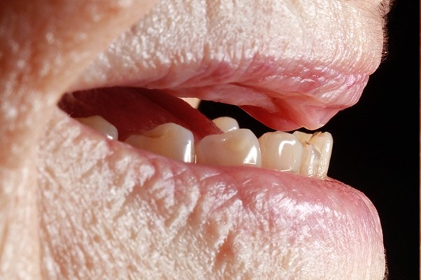 Image Image